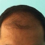 Увеличитель густоты волос MinoX Hair Magic фото 1 