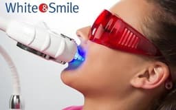 Косметическое отбеливание зубов White&Smile
