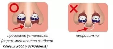 Фильтры для носа "Профилактика"