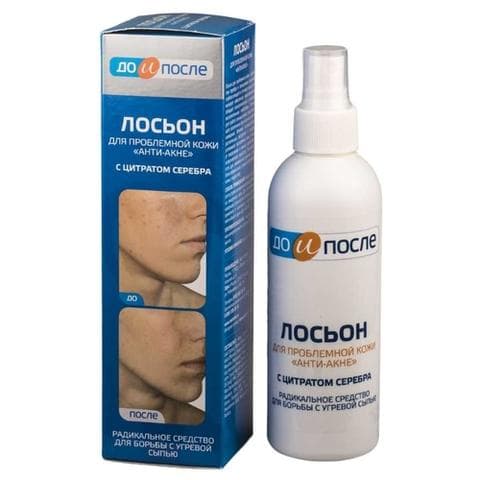 Лосьон До и после Лосьон до проблемной кожи «анти-акне