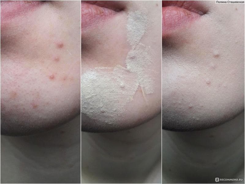 Корректор для лица Lilo Hide Imperfections — фото из отзыва «Хороший консилер дешево? Я тоже не верила...» (4 из 8)