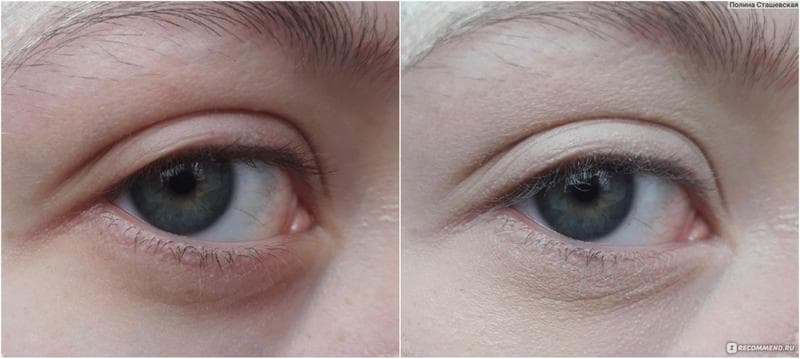 Корректор для лица Lilo Hide Imperfections — фото из отзыва «Хороший консилер дешево? Я тоже не верила...» (6 из 8)