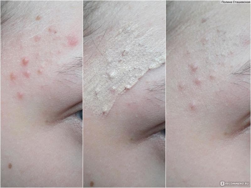 Корректор для лица Lilo Hide Imperfections — фото из отзыва «Хороший консилер дешево? Я тоже не верила...» (7 из 8)