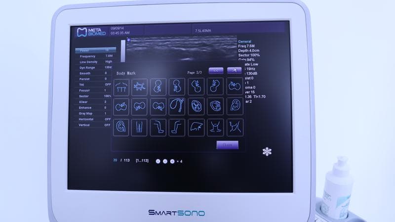УЗИ система SmartSono MS-09 — фото из отзыва «SmartSono MS-09 - достойный УЗИ аппарат из Кореи!!!» (4 из 4)