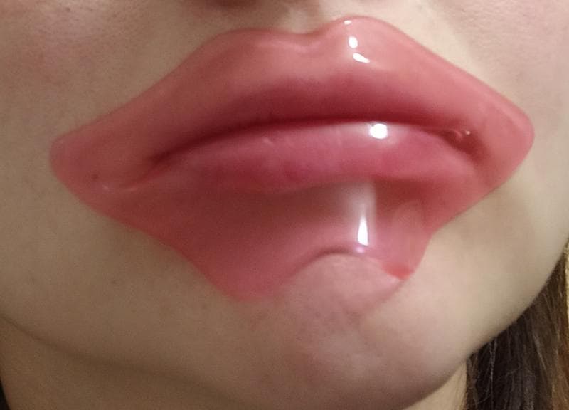 Патчи для губ Do Beauty  — фото из отзыва «Весело, но ожидаемый эффект не достигнут» (4 из 4)