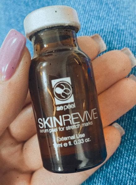 Химический пилинг Skin Revive — фото из отзыва «Сделала курс процедур, кожа заметно посветлела, стрии стали » (2 из 3)