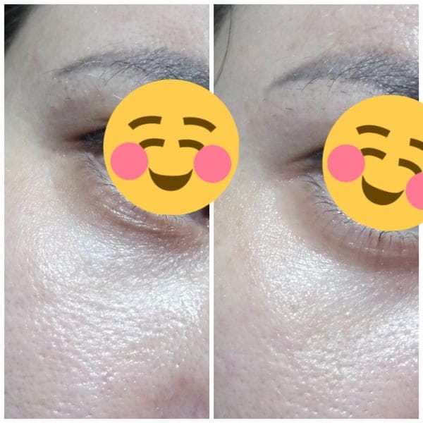 Гель для глаз Compliment Hydralift — фото из отзыва «Эффект заметен»