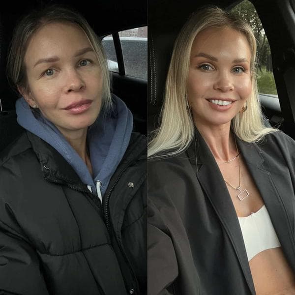 Бюстклиника — фото из отзыва «Профи»