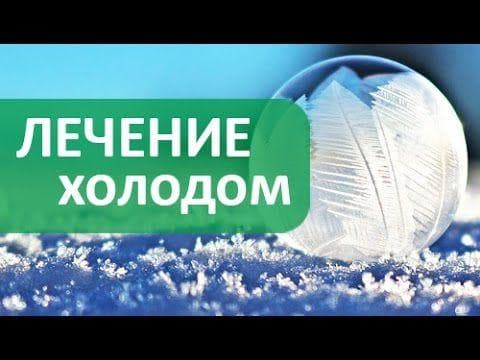 Криотерапия